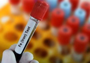 علامت که نشان می‌دهد به فقر آهن مبتلا هستید