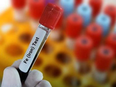 علامت که نشان میدهد به فقر آهن مبتلا هستید