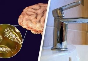 هنگام شست‌وشوی صورت، مراقب ورود موجودات مغزخوار به بینی خود باشید