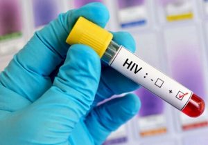 درمان موفق HIV در آستانه آزمایشات انسانی