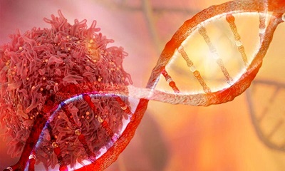 توسعه روشی جدید برای از بین بردن سلول های سرطانی