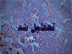 دانشگاههای آذربایجانشرقی تا پایان سال تعطیل شدند