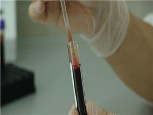 ویروس هانتا چیست؟ ثبت نخستین مورد مرگ در چین در بحبوحه بحران کرونا