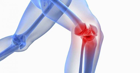 درمان مینیسک زانو با چند حرکت ورزشی