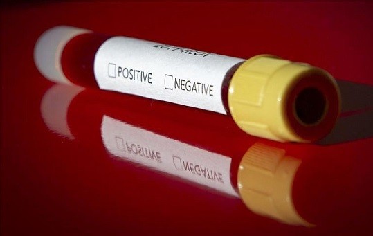 وزارت بهداشت برای پاسخ به سوالات درباره ویروسِ کرونا ۲هزار خط تلفن اختصاص داده