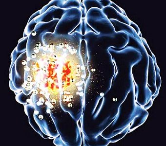 نابودی تومورهای مغزی با یک دستگاه بی‌سیم