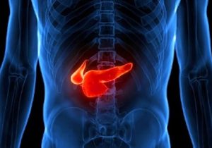 جستجو و نابودی سرطان لوزالمعده با رویکردی جدید