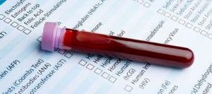 تشخیص سرطان با کمتر از ۰.۰۵ میلی‌متر خون خشک شده